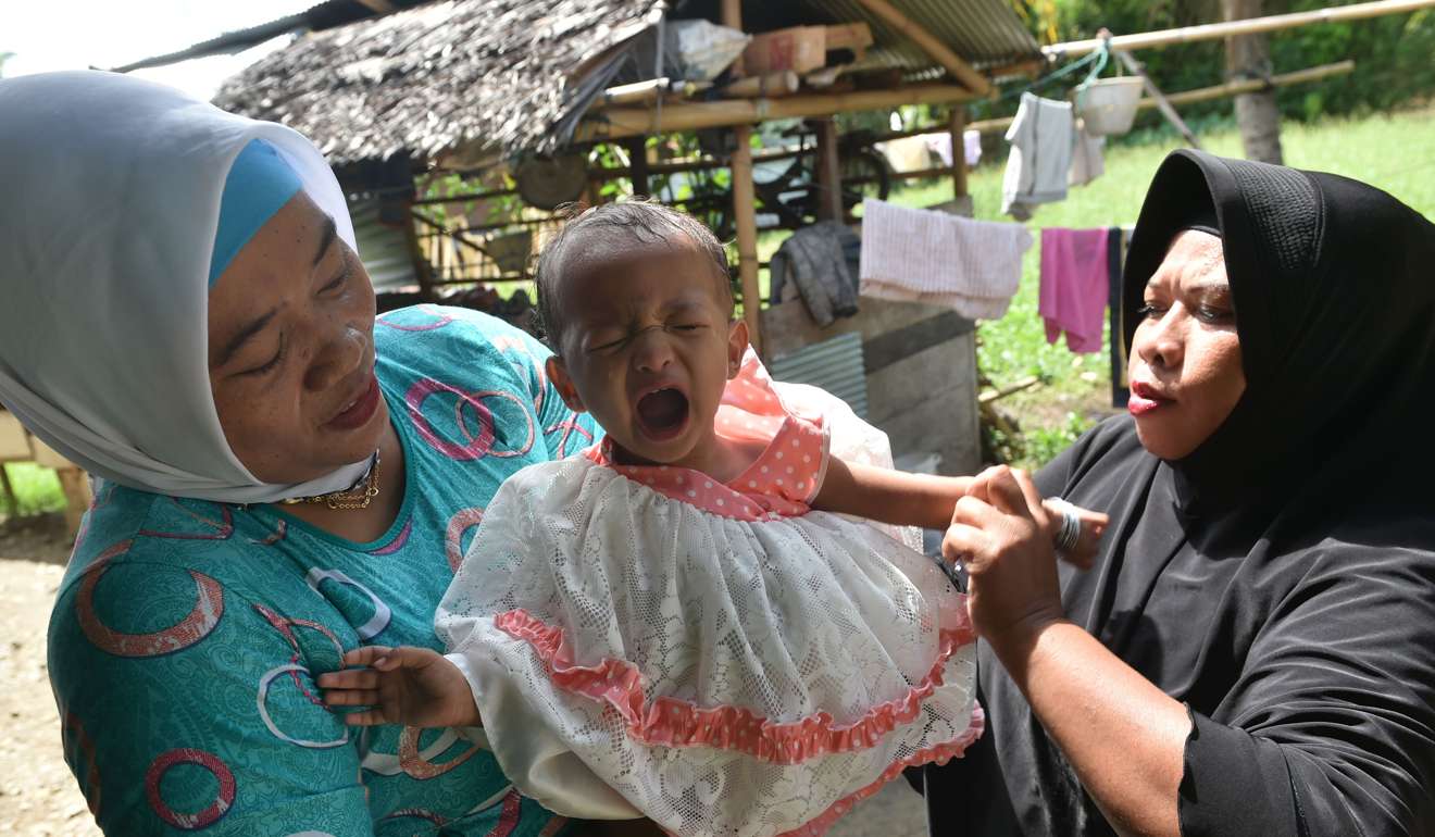 Toddler Salsa Djafar cries after a traditional healer conducted a circumcision in Gorontalo. Photo: AFP
