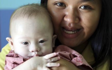 Thai surrogate mother Pattaramon Chanbua, a 21-year-old food vendor, poses with Gammy, who was born with Down's syndrome. Photo: AP