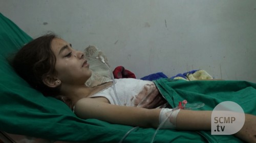 Doctors treat severely wounded children at an Aleppo hospital
