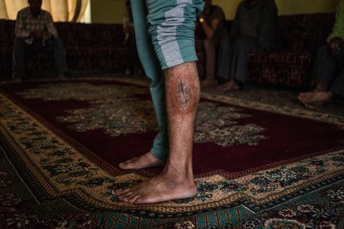 Islamic State victim Imad shows a bullet wound on his left leg that he says he suffered during a mass execution from which he escaped. Photo: Alice Martins / The Washington Post Islamic State victim Imad shows a bullet wound on his left leg that he says he suffered during a mass execution from which he escaped. Photo: Alice Martins / The Washington Post