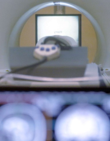 The superconductive magnet could lead to medical scanners precise enough to image neurons, researchers say The superconductive magnet could lead to medical scanners precise enough to image neurons, researchers say