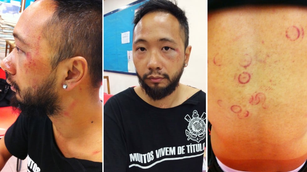 Résultat de recherche d'images pour "beating of Ken Tsang"
