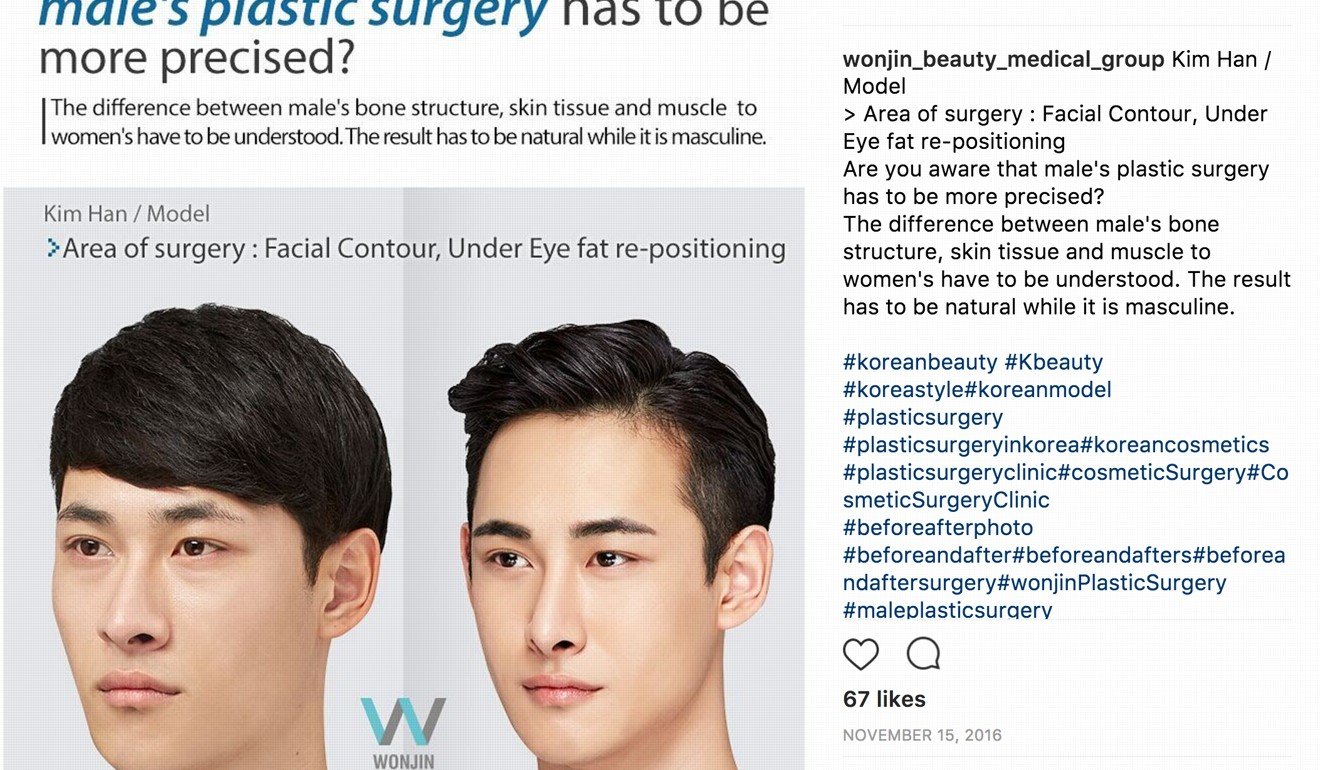 South Korean Men Having Plastic Surgery To Get Pretty Boy Looks And Macho Physiques Of Their K Pop And K Drama Idols South China Morning Post