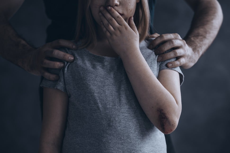 In 2016, the World Health Organisation reported that one in five women and one in 13 men have been sexually abused as a child. Photo: Shutterstock