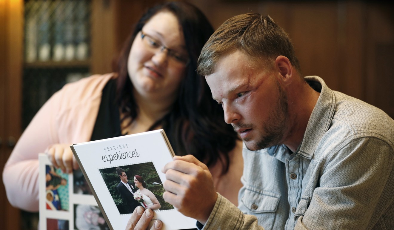 Lilly Ross, left, shows her family photos to Andy Sandness during their meeting at the Mayo Clinic. Photo: AP