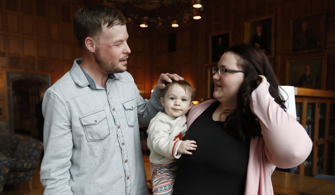 Lilly Ross, right, holds her 17-month-old son Leonard as she talks with face transplant recipient Andy Sandness. Photo: AP