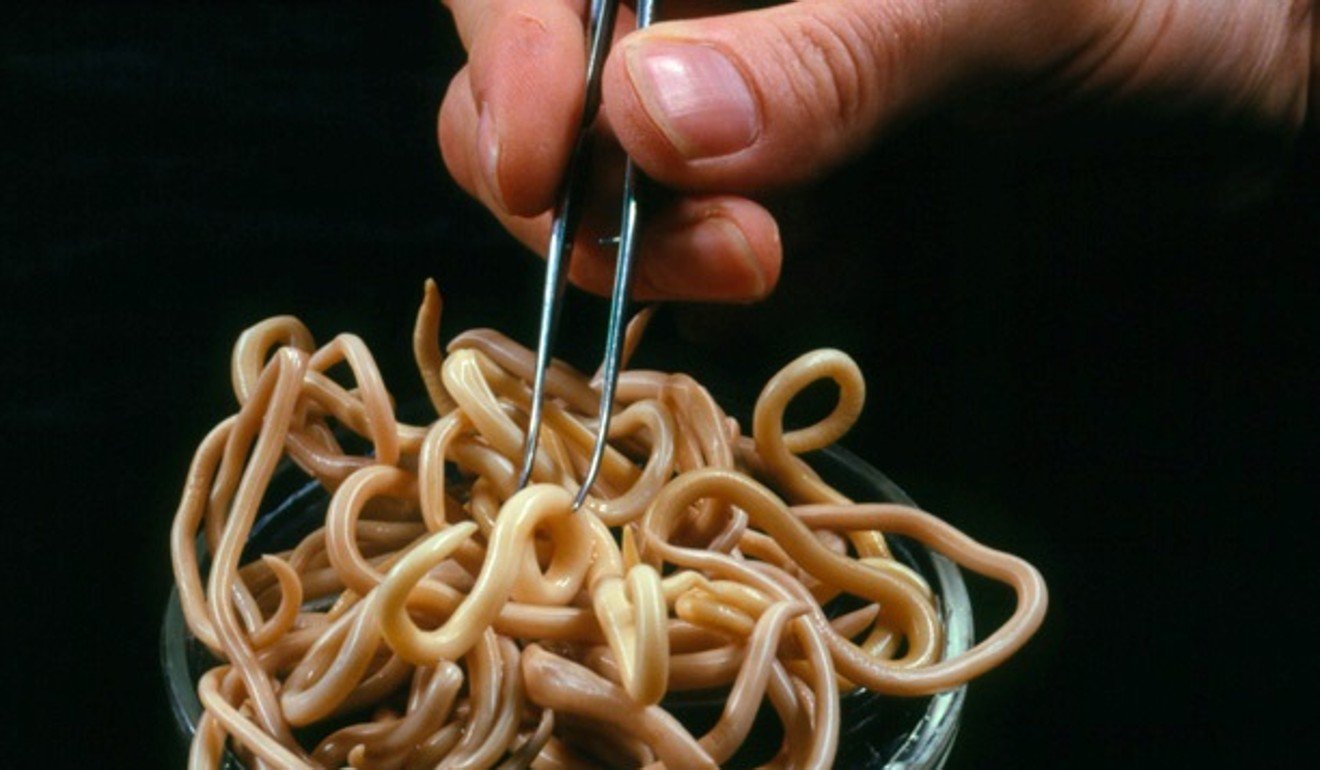 Human roundworms, seen here in a file photo, infested the digestive system of a North Korean defector, South Korean doctors say. Photo: Handout