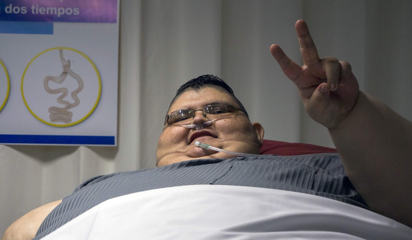 Juan Pedro Franco recovers from his first gastric bypass operation in December 2016. Photo: Agence France-Presse