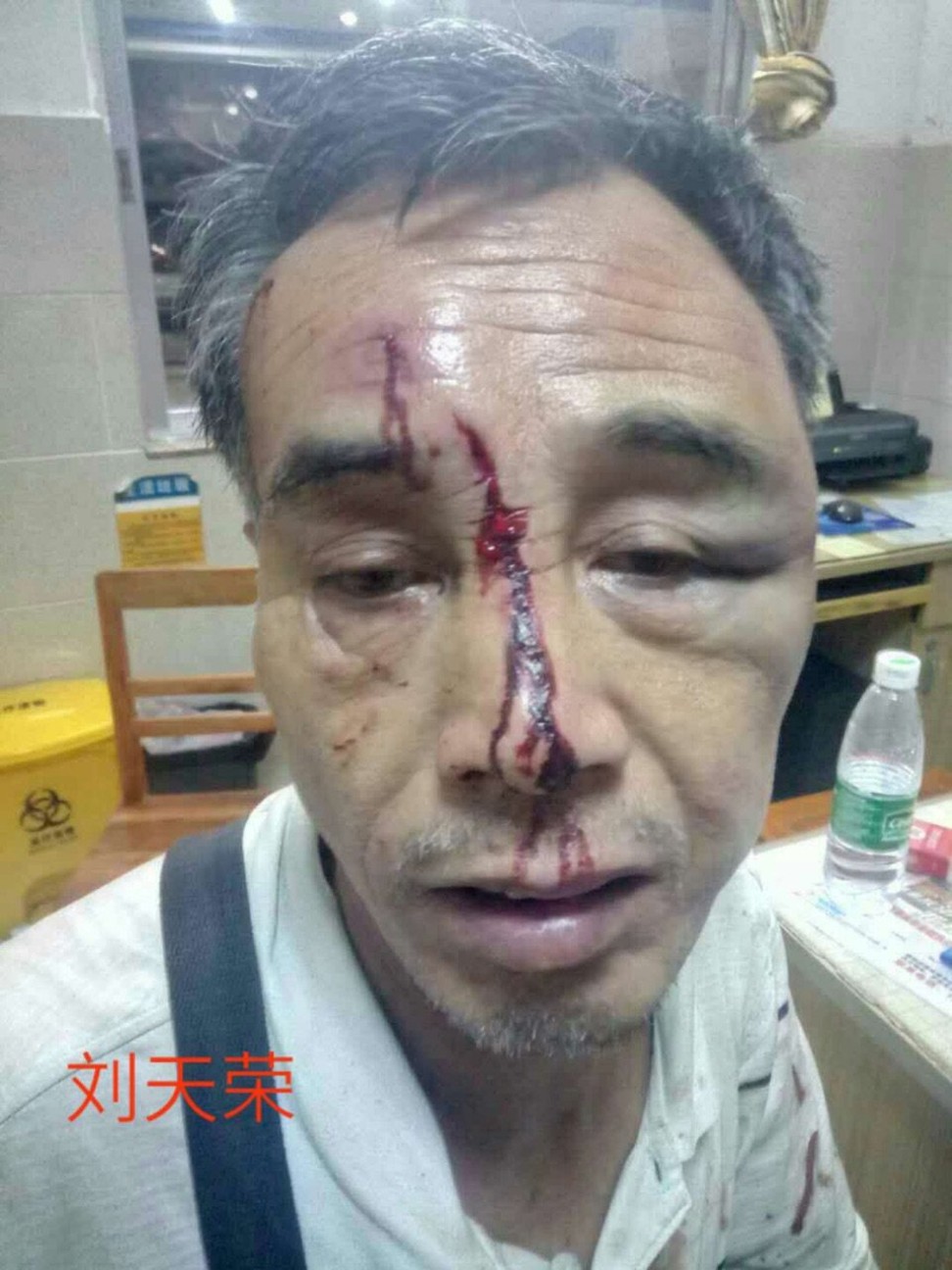 Retired military man Liu Tianrong, 60, needed hospital treatment after being beaten up while trying to petition Beijing for better treatment for veterans. Photo: Liu Tianrong