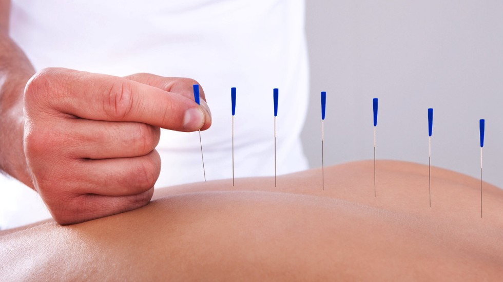Acupuncture Clinic Business Plan midtonesdesign