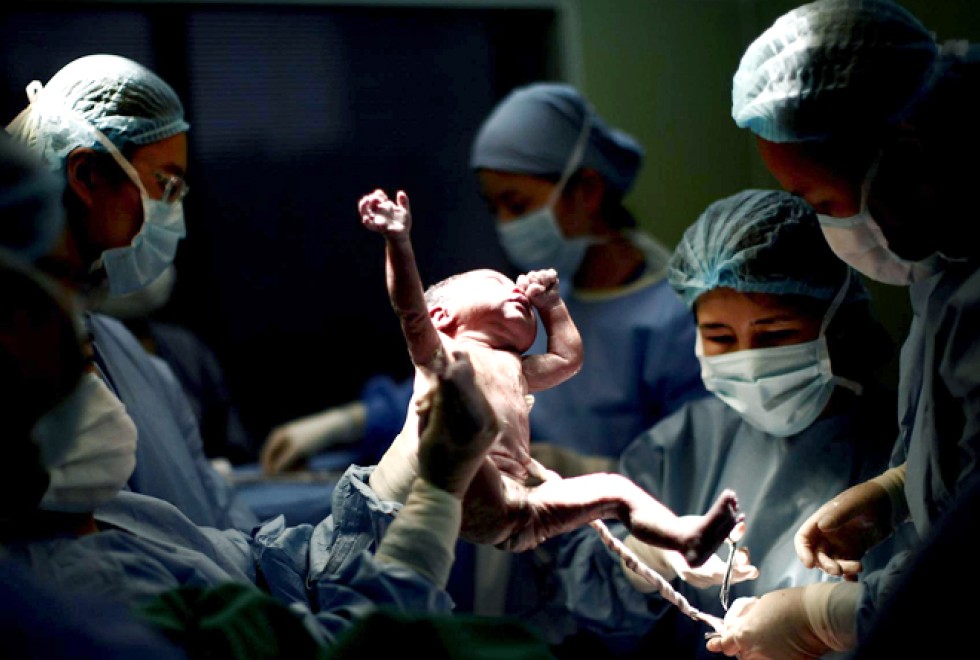 Nearly one in two Chinese mothers chose to give birth by caesarean ...